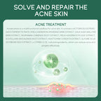 Acne Treatment Gel