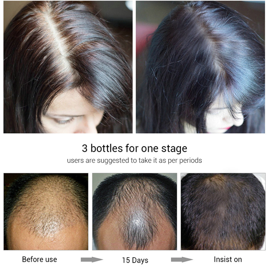 Efero Hair Growth Fluid