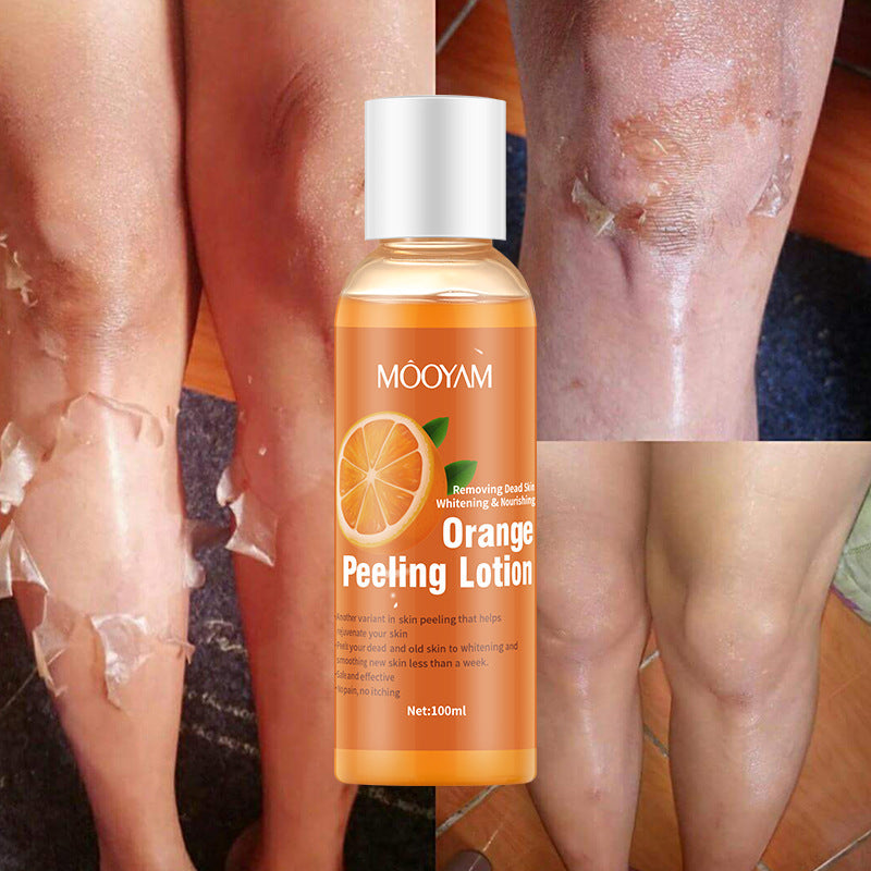 MOOYAM™ Orange Glow Peeling Lotion