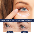 Eye Repair Serum with Collagen Rice Protein & Hyaluronic Acid